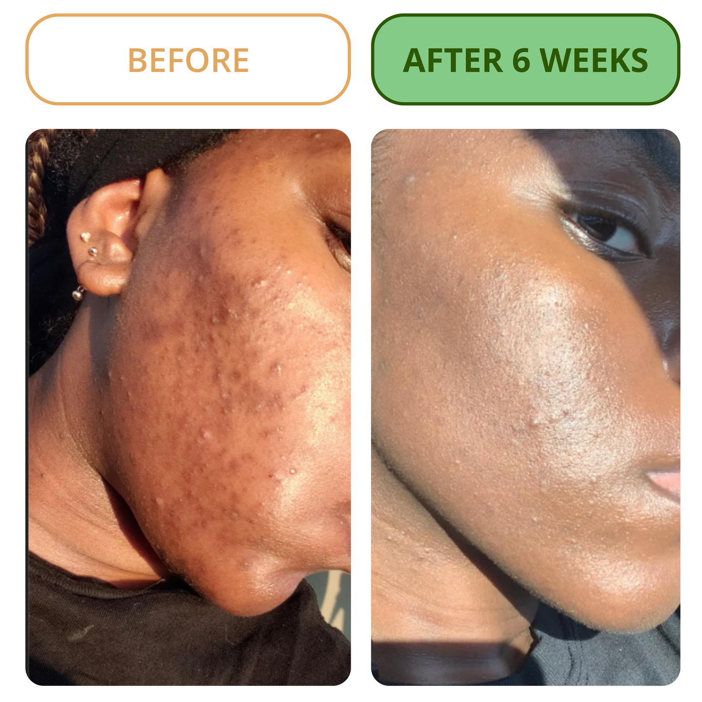 Melanin Labs | Toner Pad Formula