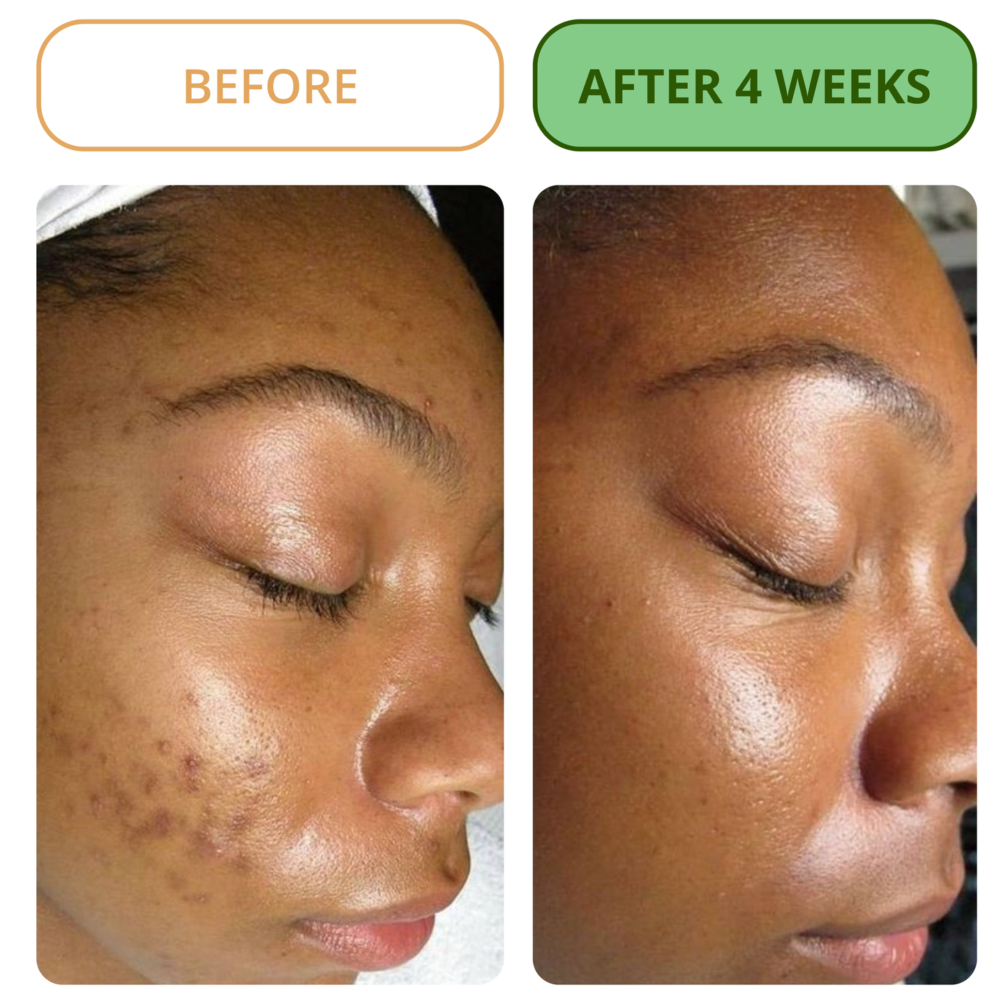 Melanin Labs | Toner Pad Formula